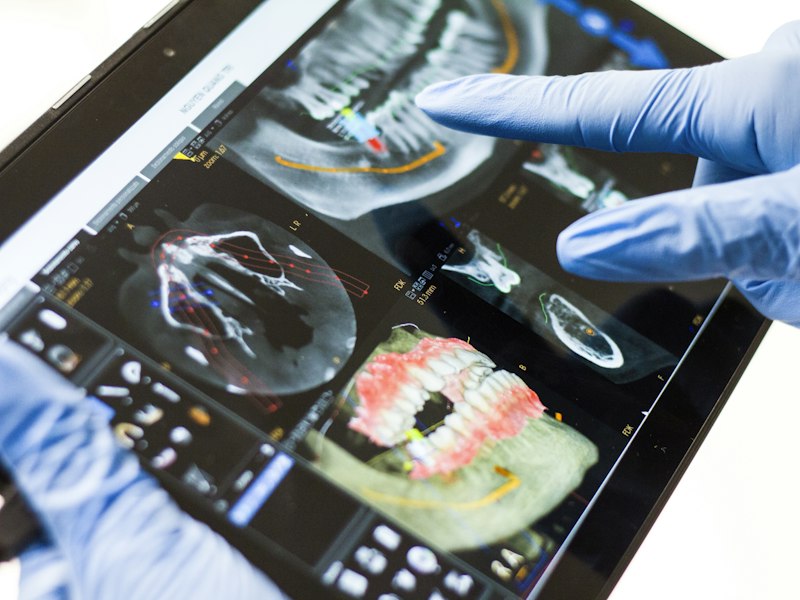 Gloved hand reviewing a 3D dental scan on a tablet